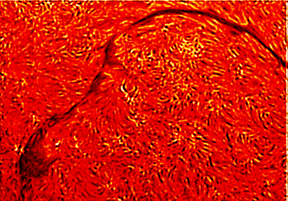 世界杯投注平台